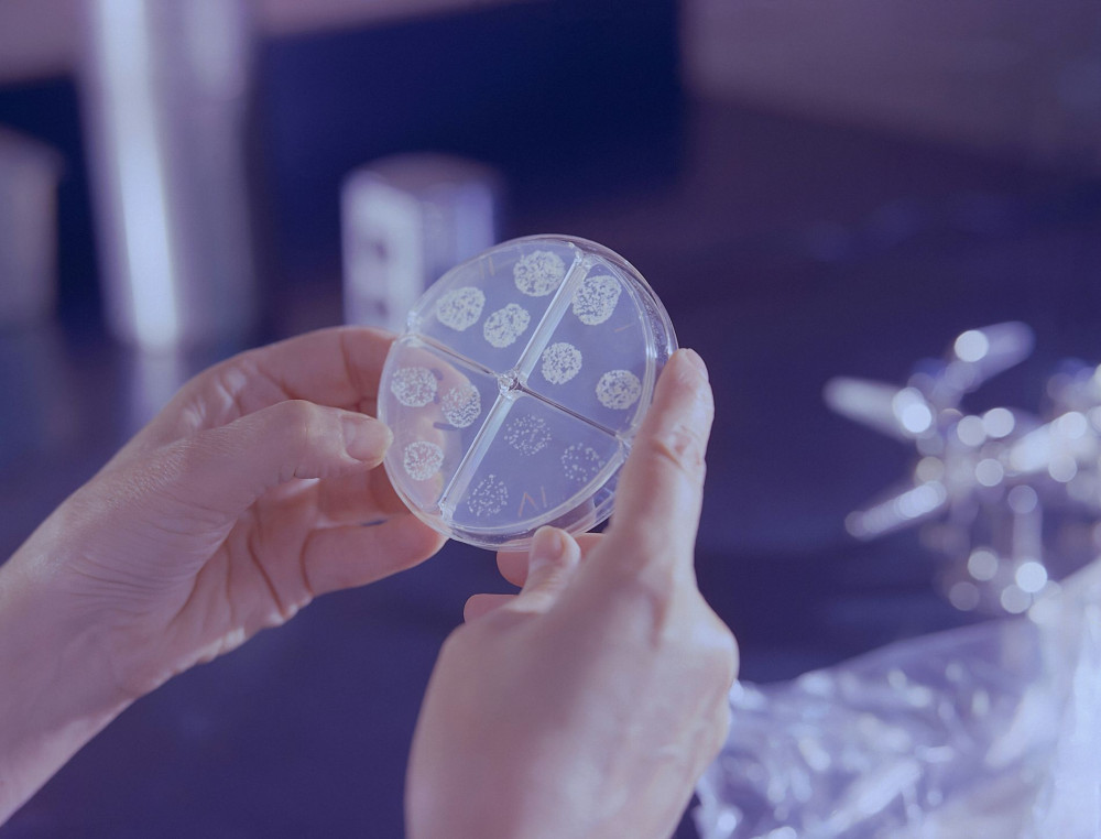 A person holding a petri dish with bacterial cultures
